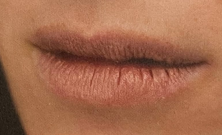 Lip ppearanceand texture