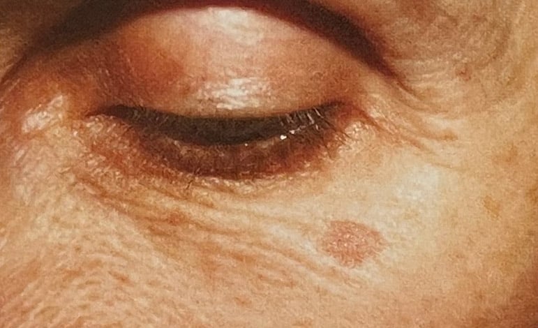 Skin texture and appearance