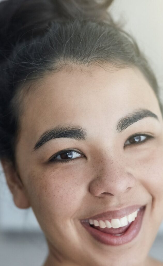 Young woman with freckles smiling confidently — Cornerstone Dental Arts patient smile gallery Knoxville TN